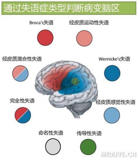 失语精灵图2